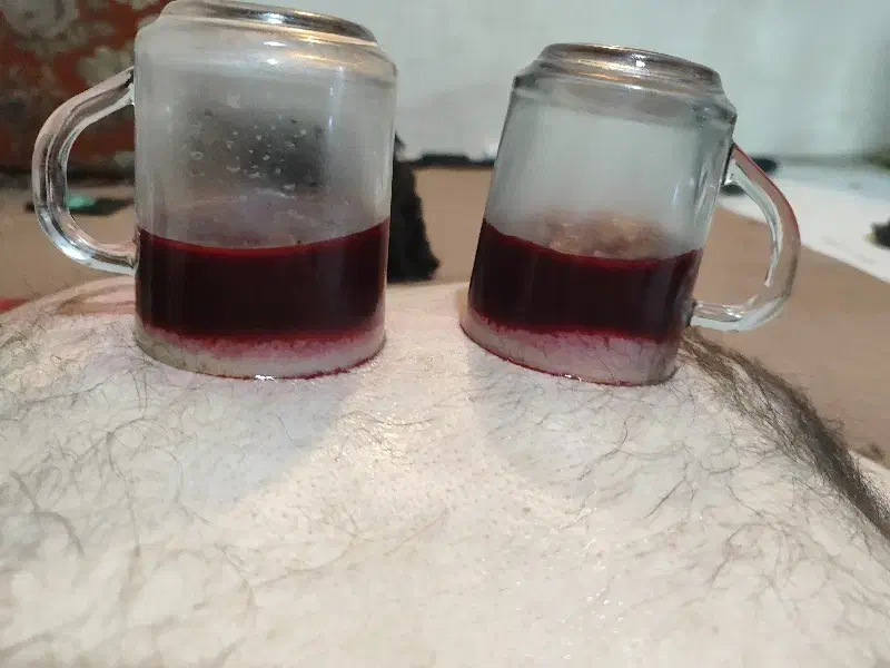 طب سنتی همه کار|خدمات آرایشگری و زیبایی|محمدشهر, همایون ویلا|دیوار