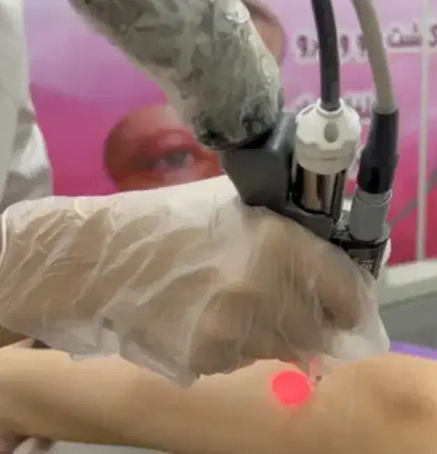 جشنواره مرکز کلینیک لیزر|خدمات آرایشگری و زیبایی|نجف‌آباد, بازار|دیوار