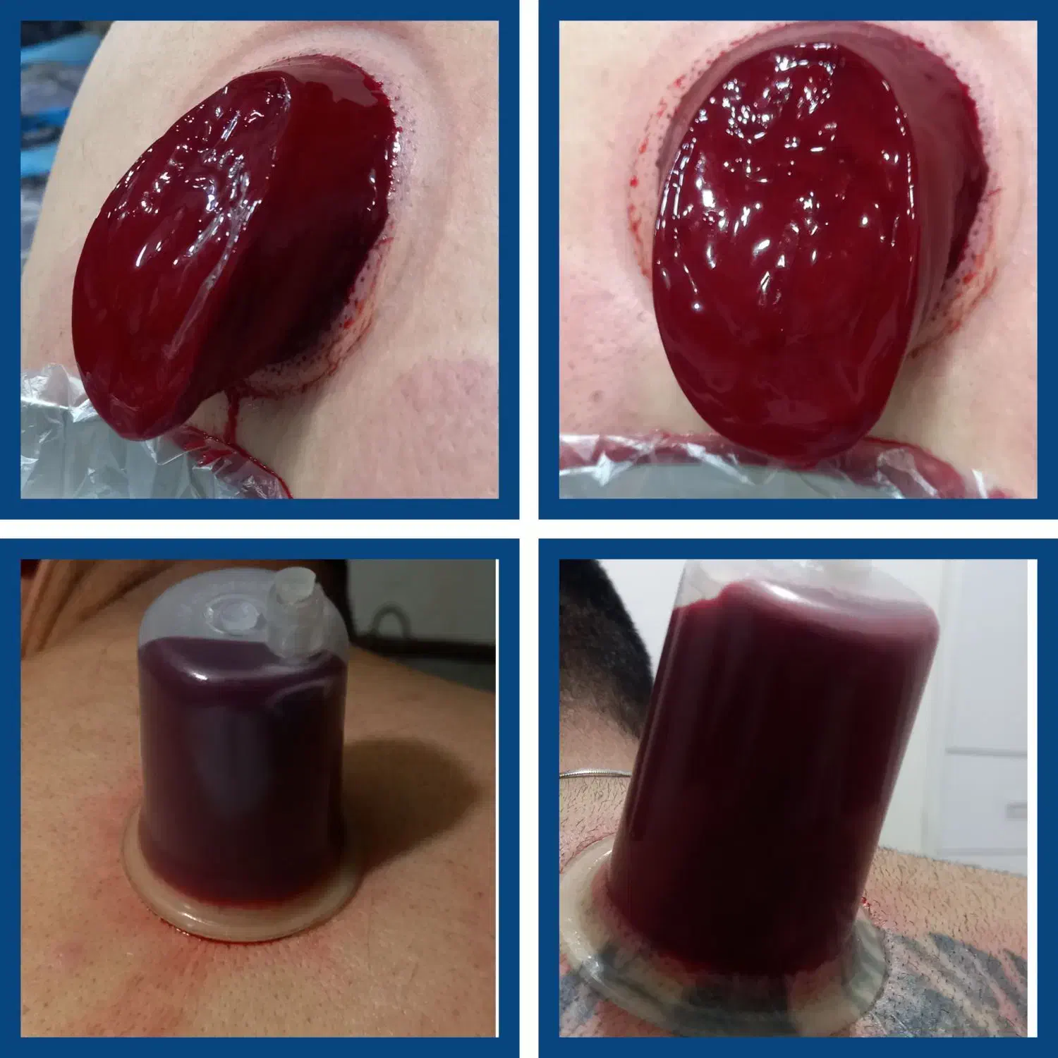 حجامت/بادکش/زالو/ناف گیر/ماسـاژدرمنــزل شـما|خدمات آرایشگری و زیبایی|کرمانشاه, |دیوار