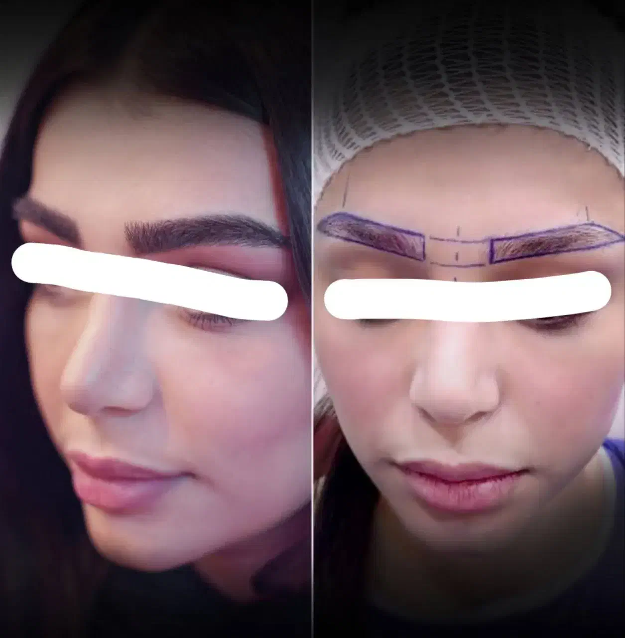 اقساطی/کاشت مو تضمینی/کاشت ابرو/ژل لب|خدمات آرایشگری و زیبایی|سنندج, |دیوار