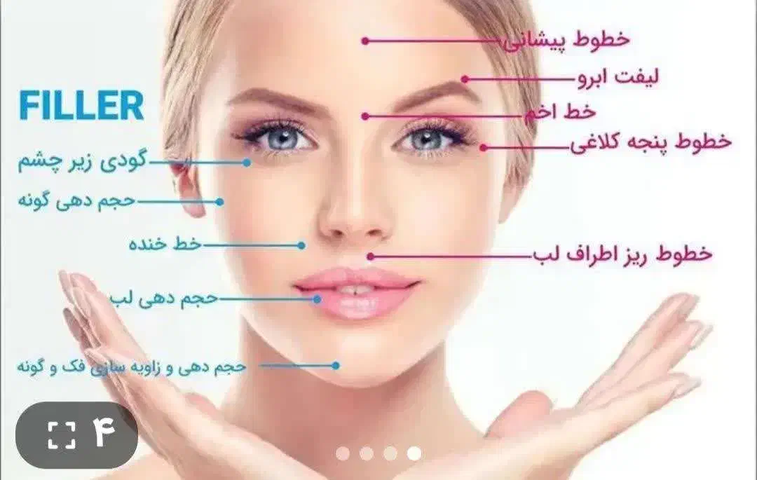 جشنواره تخفیف ویژه ۵۰ درصد بوتاکس ژل مزو چربی فیلر|خدمات آرایشگری و زیبایی|اصفهان, جویباره|دیوار