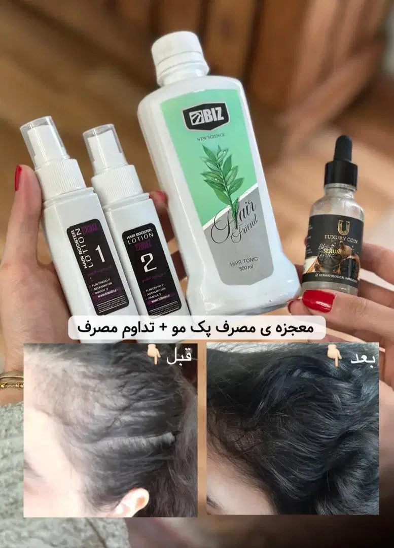 یک بار برای همیشه با ریزش مو هات خداحافظی کن|آرایشی، بهداشتی، درمانی|شیراز, چنچنه|دیوار