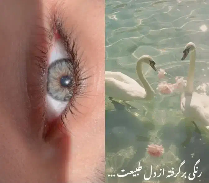 لنز چشم|آرایشی، بهداشتی، درمانی|گلستان (تهران), |دیوار