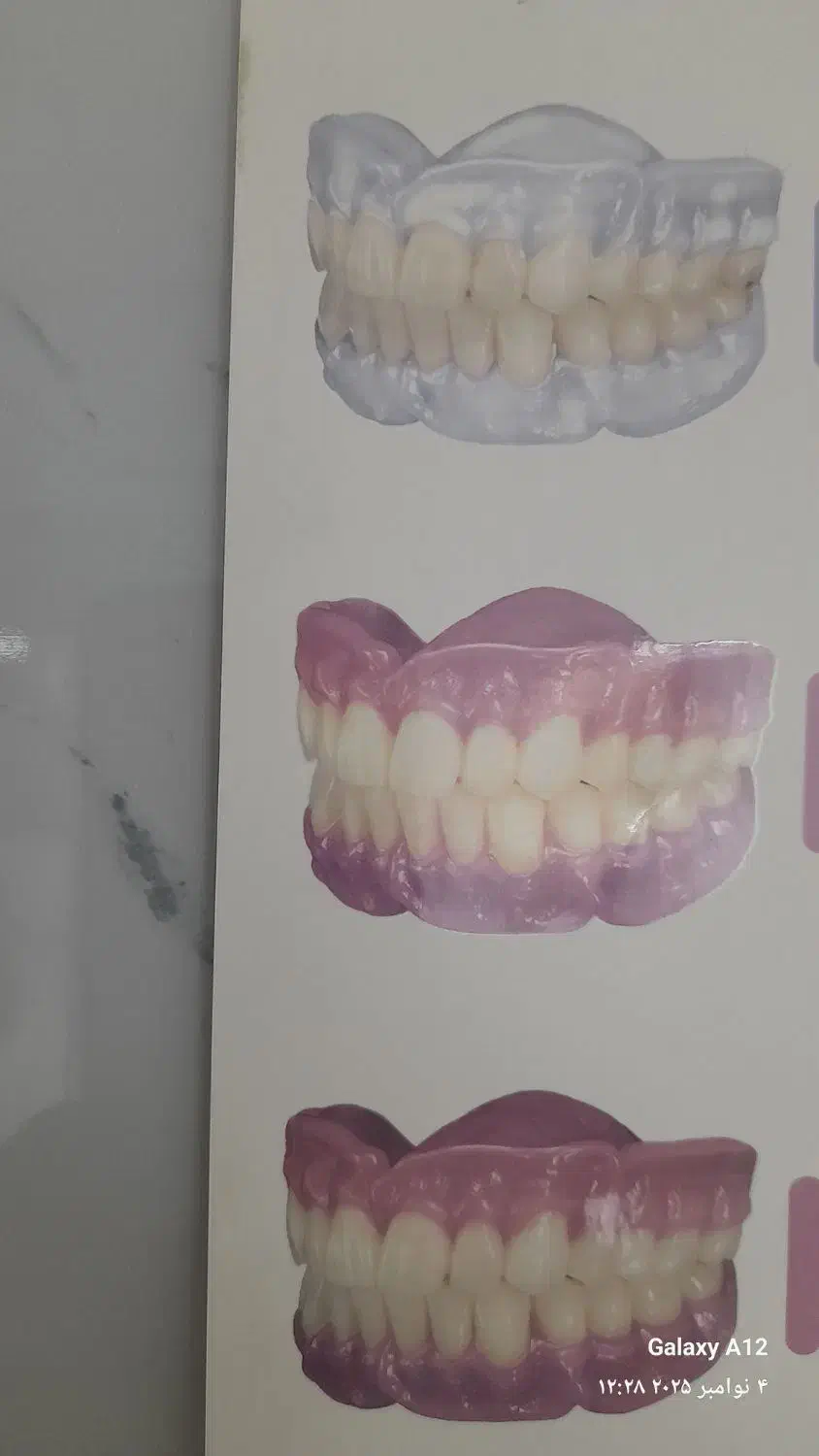 پروتز دندان متحرک و تعمیر، با قالبگیری در محل|خدمات آرایشگری و زیبایی|تهران, والفجر (افسریه)|دیوار