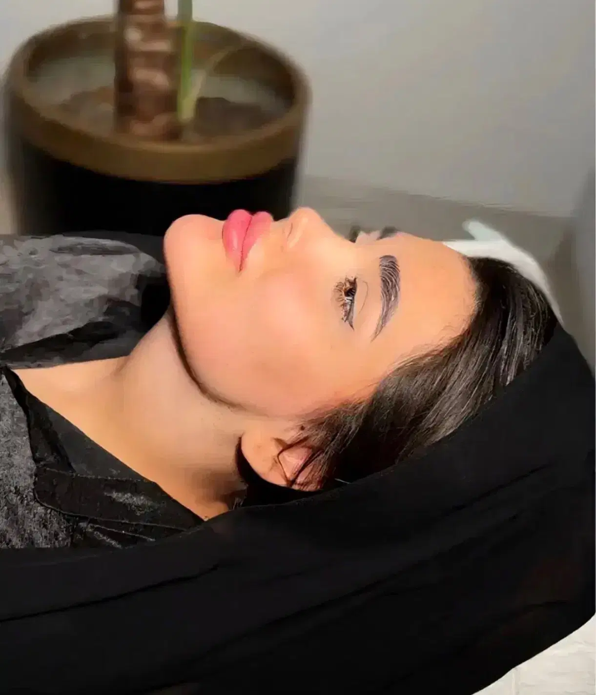 لیپو ساکشن غبغب متدوی لاین ،لیپوغبغب،کلینیک زیبایی|خدمات زیبایی و سلامت|شیراز, قدوسی شرقی|دیوار