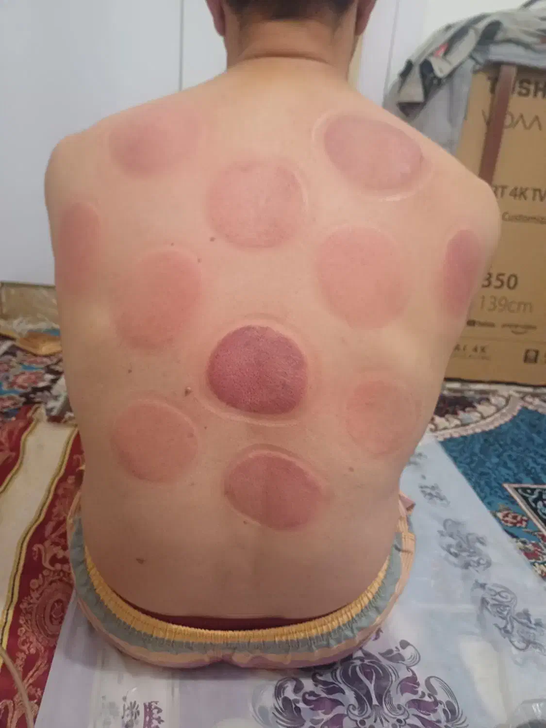 حجامت معجزه میکنه|آرایشی، بهداشتی، درمانی|بندر کنگان, |دیوار