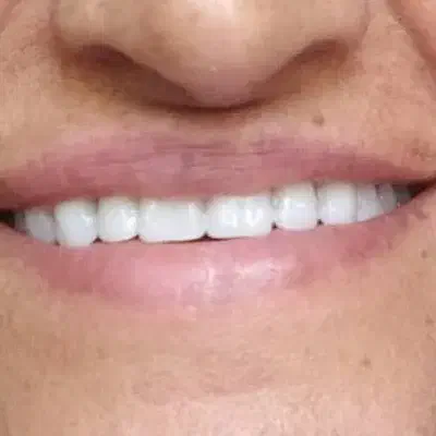 دندان مصنوعی|پزشکی|کرمانشاه, |دیوار