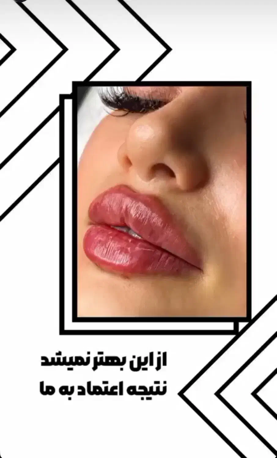 تخفیف ویژه خدمات ژل و بوتاکس|خدمات آرایشگری و زیبایی|زابل, |دیوار