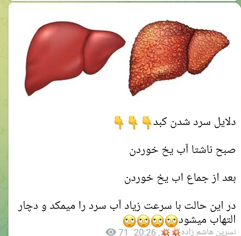 خاکشیر|فعالیت داوطلبانه|سر آسیاب یوسفی, |دیوار