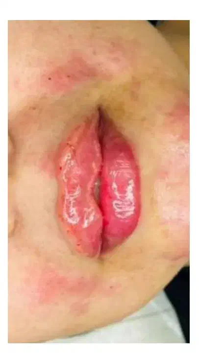 آموزش و انجام تمام خدمات ژل و بوتاکس|خدمات آرایشگری و زیبایی|هشتگرد, شهرک ولیعصر (مصلی)|دیوار