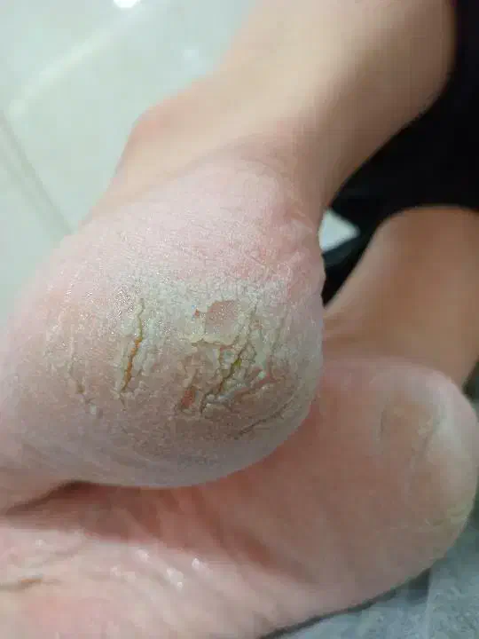 فروش وسایل پدیکور|آرایشی، بهداشتی، درمانی|اسلامآباد غرب, |دیوار