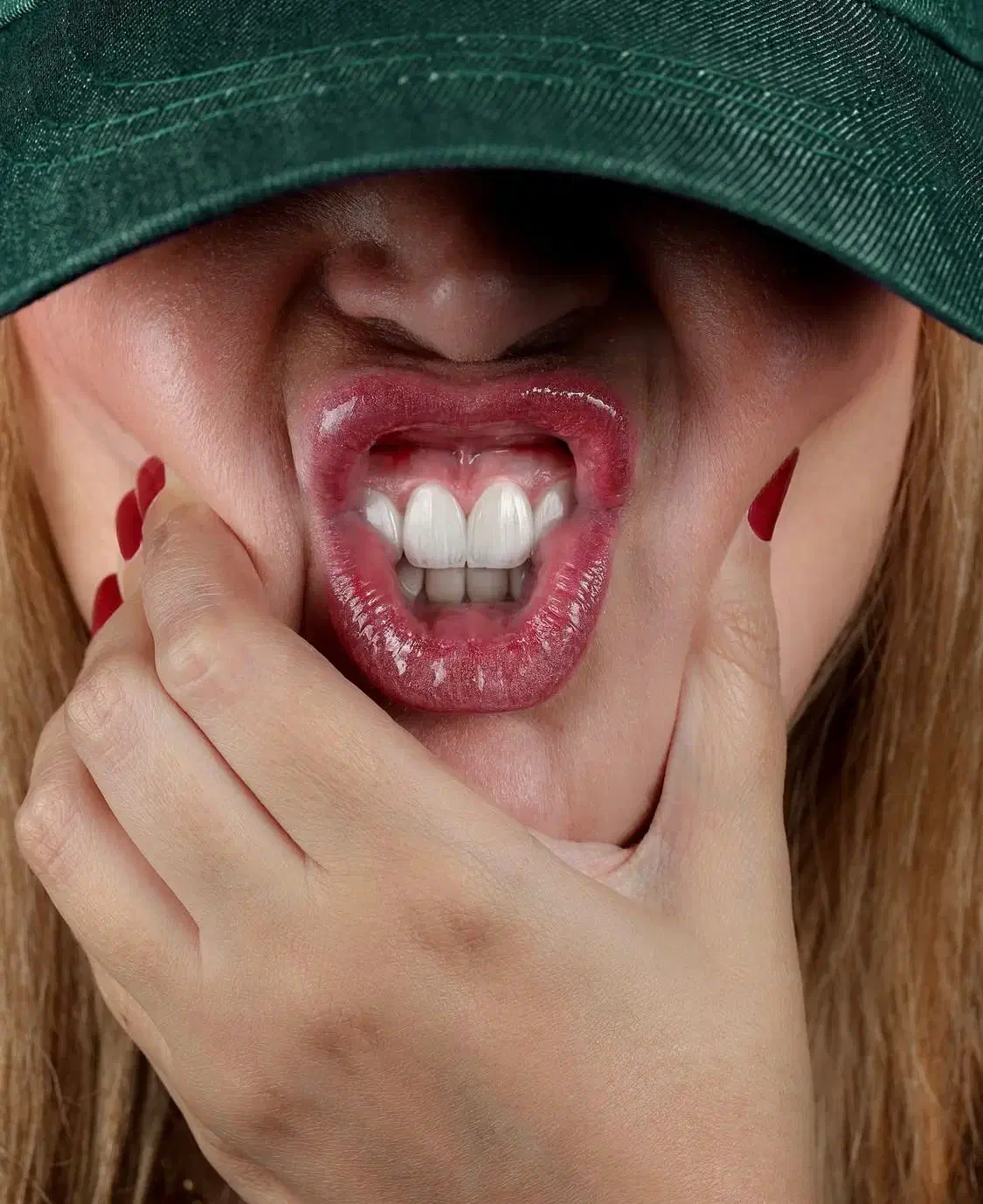 ایمپلنت سوئدی با روکش ۱۴/۹۰۰|خدمات آرایشگری و زیبایی|تهران, صادقیه|دیوار