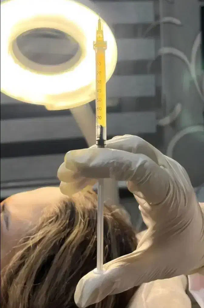 پی آر پی حجامت امبدینگ طب سوزنی زالو بادکش|خدمات آرایشگری و زیبایی|اصفهان, فروردین|دیوار