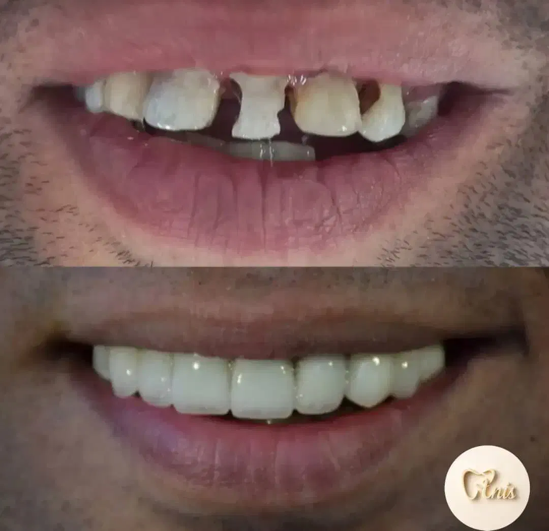 دندان پزشکی|خدمات آرایشگری و زیبایی|قم, نوقطار|دیوار