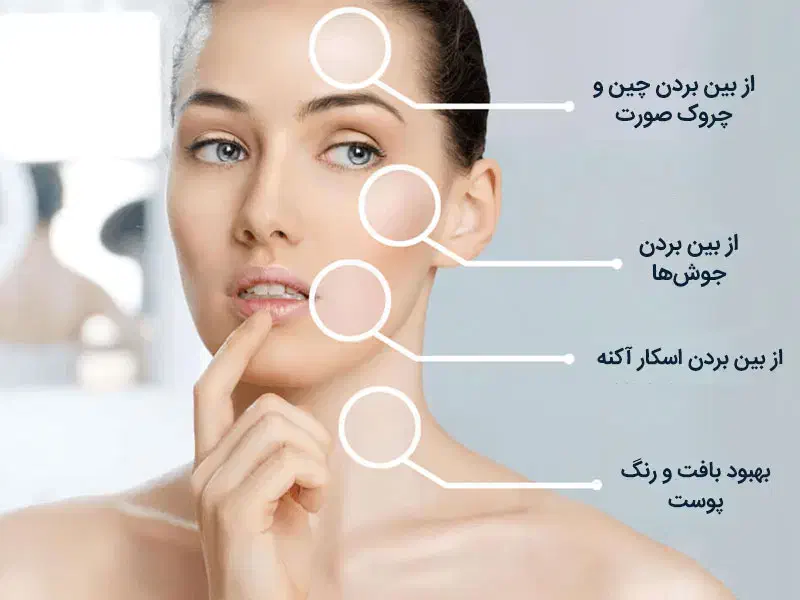 مزونیدلینگ معجزه زیبایی پوست|خدمات آرایشگری و زیبایی|اهواز, شریعتی جنوبی|دیوار