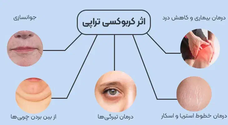 کربوکسی تراپی|خدمات آرایشگری و زیبایی|رفسنجان, |دیوار