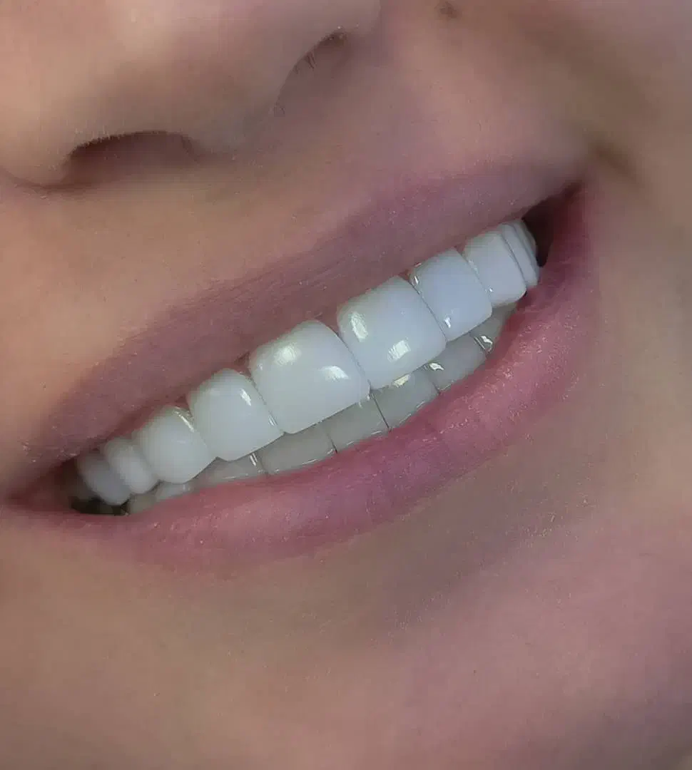 استخدام ویزیتور و بازاریاب کامپوزیت دندان|استخدام بازاریابی و فروش|یاسوج, |دیوار