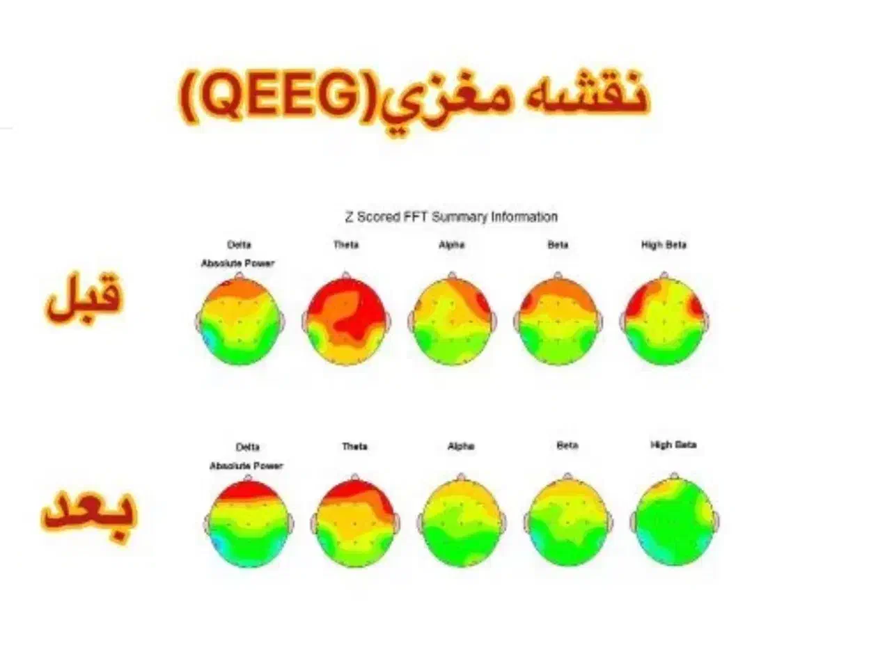 فروش دستگاه نقشه مغزی|پزشکی|شیراز, ستارخان|دیوار
