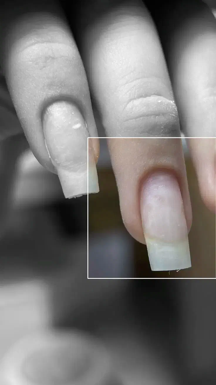 کاشت و ترمیم ناخن|خدمات آرایشگری و زیبایی|ارومیه, |دیوار