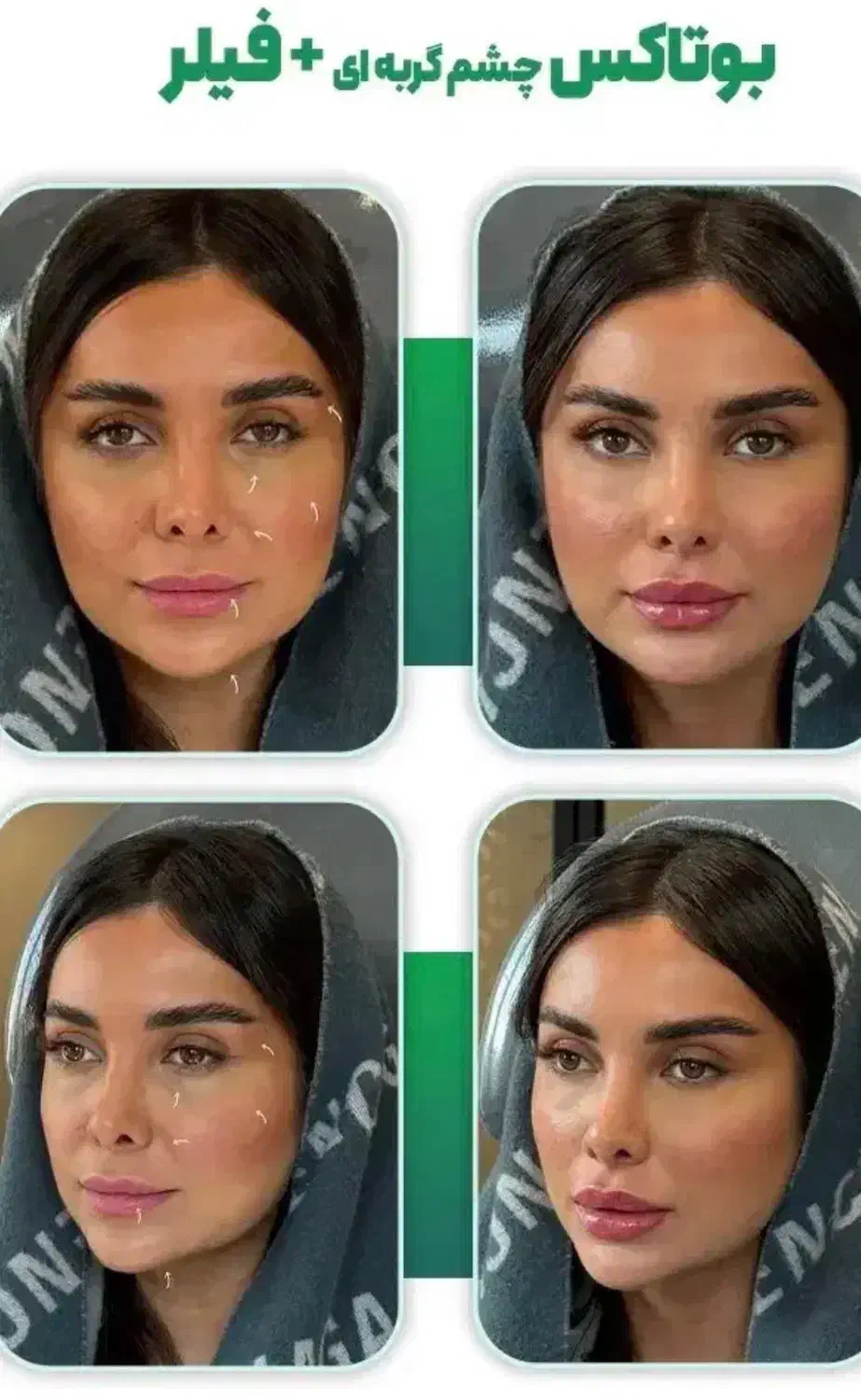 مدل جهت فیلر لیبل دار ،دارای تاییدیه بین المللی|خدمات آرایشگری و زیبایی|ری, دولت‌آباد|دیوار