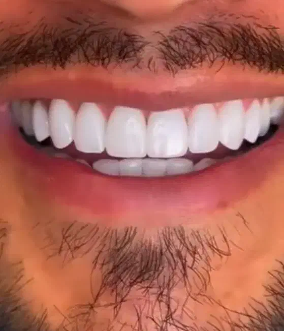 دندانپزشکی|آرایشی، بهداشتی، درمانی|ارومیه, |دیوار