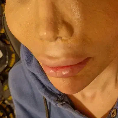 تزریق تخصصی ژل و بوتاکس رشت|خدمات آرایشگری و زیبایی|رشت, بلوار گیلان|دیوار