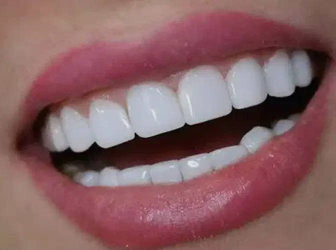 خدمات دندانی|خدمات آرایشگری و زیبایی|زنجان, |دیوار