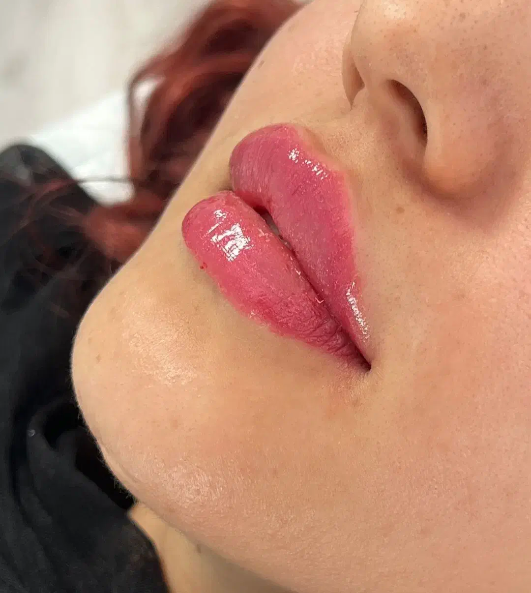 تزریق ژل و بوتاکس در کلینیک زیبایی|خدمات آرایشگری و زیبایی|کرمانشاه, |دیوار