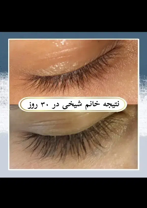 برای مژه و ابرو طبیعی و دائمی باید اقدام کنی|آرایشی، بهداشتی، درمانی|فیروزآباد (فارس), |دیوار