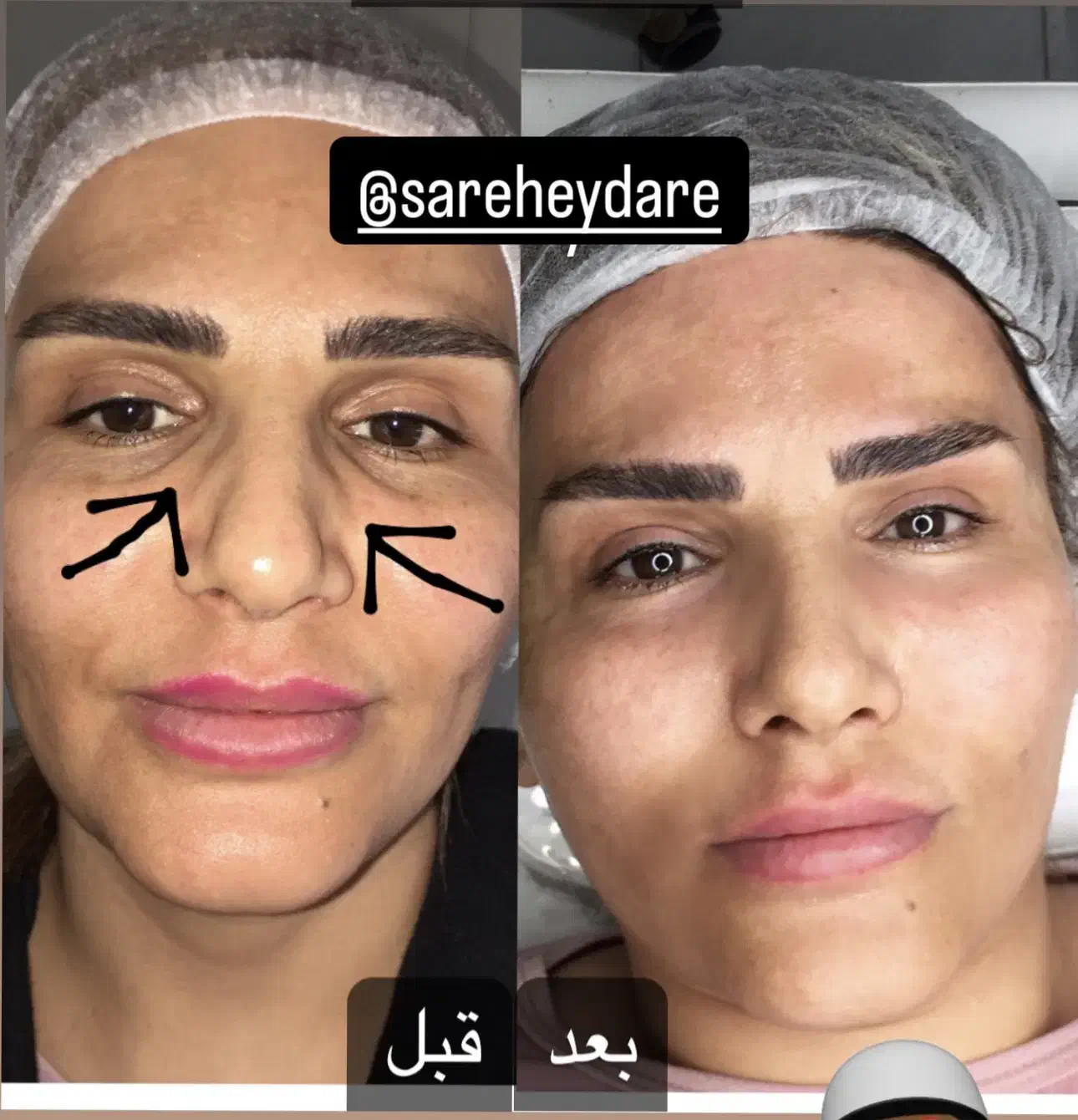 جشنواره هایفو و فیشیال|خدمات آرایشگری و زیبایی|کرج, حسن آباد|دیوار