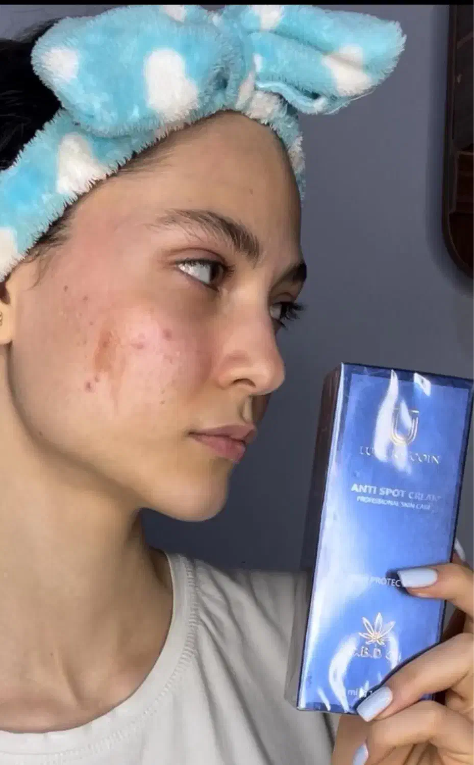 کرم ضدلک لاکچری کوین(کرم ۸ کاره)|آرایشی، بهداشتی، درمانی|شیراز, ملاصدرا|دیوار