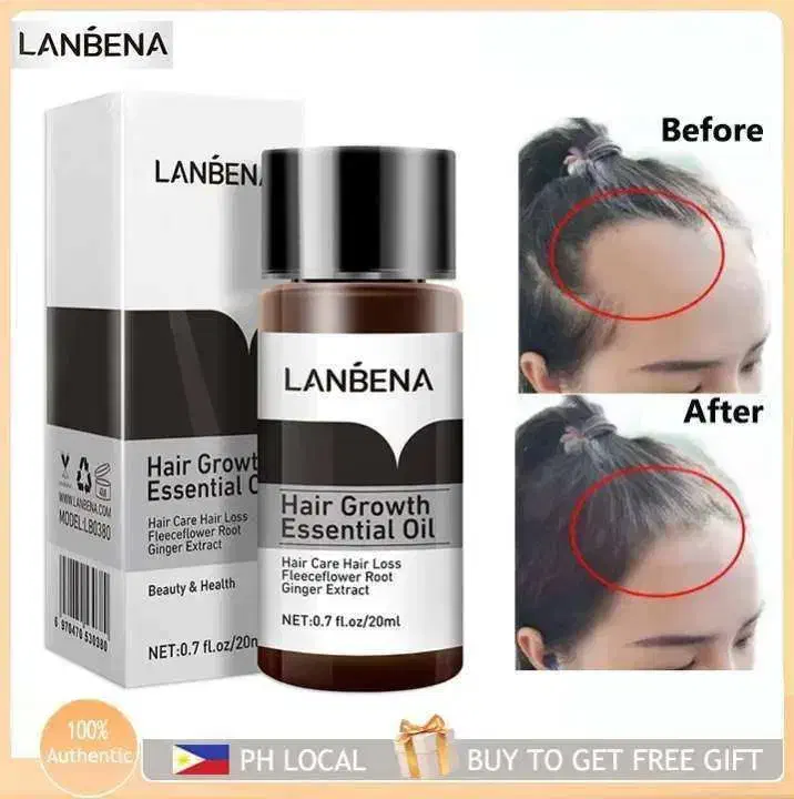 روغن رفع کچلی میخوای کچل نشی بزن|آرایشی، بهداشتی، درمانی|بومهن, |دیوار