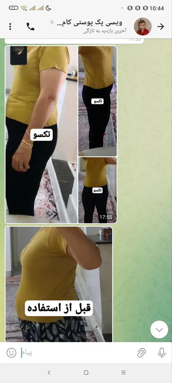 لاغری بدون ورزش و رژیم|آرایشی، بهداشتی، درمانی|رضویه, |دیوار