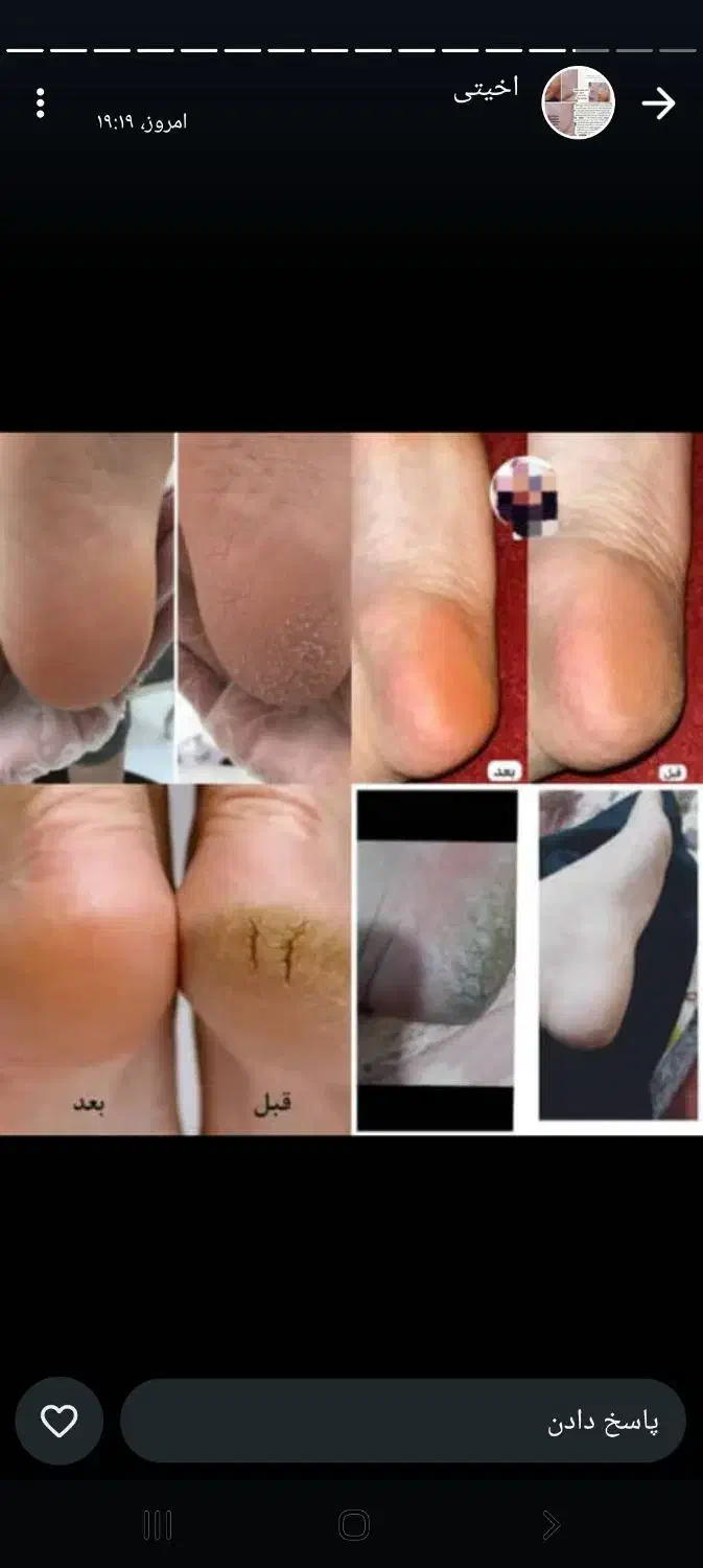 خوراکی|آرایشی، بهداشتی، درمانی|اهواز, کوی رمضان|دیوار