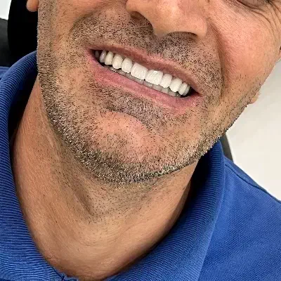 دندانسازی آوا قرارداد مستقیم کلیه بیمه ها|خدمات آرایشگری و زیبایی|خرم‌آباد, |دیوار