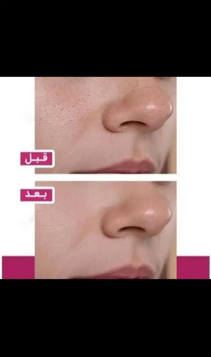 ژل گیاهی جوانسازی ضدلک ضدجوش ضدکک مک|آرایشی، بهداشتی، درمانی|بروجرد, |دیوار