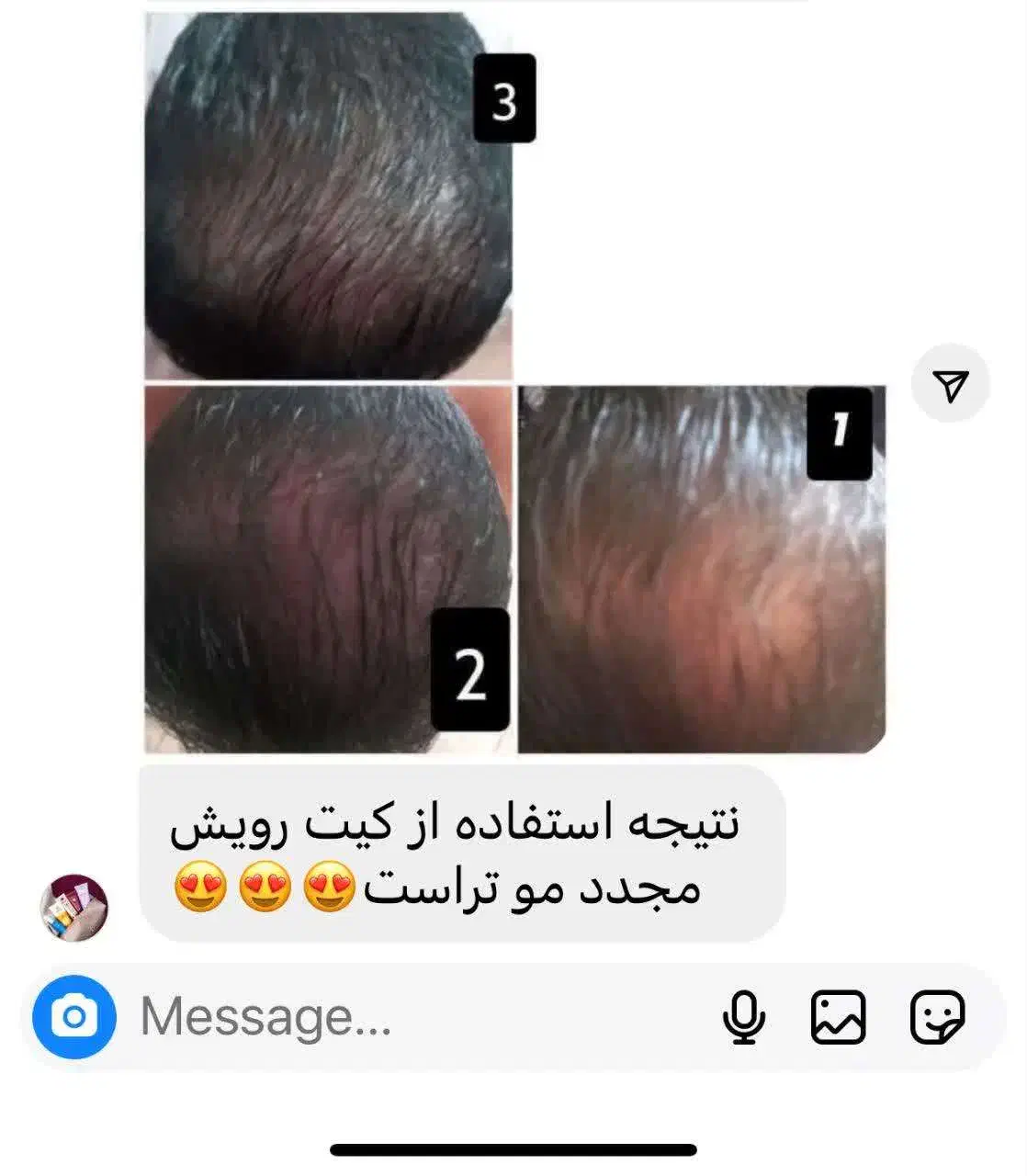 مشاوره پوست ومو|آرایشی، بهداشتی، درمانی|محمدیه-قزوین, |دیوار