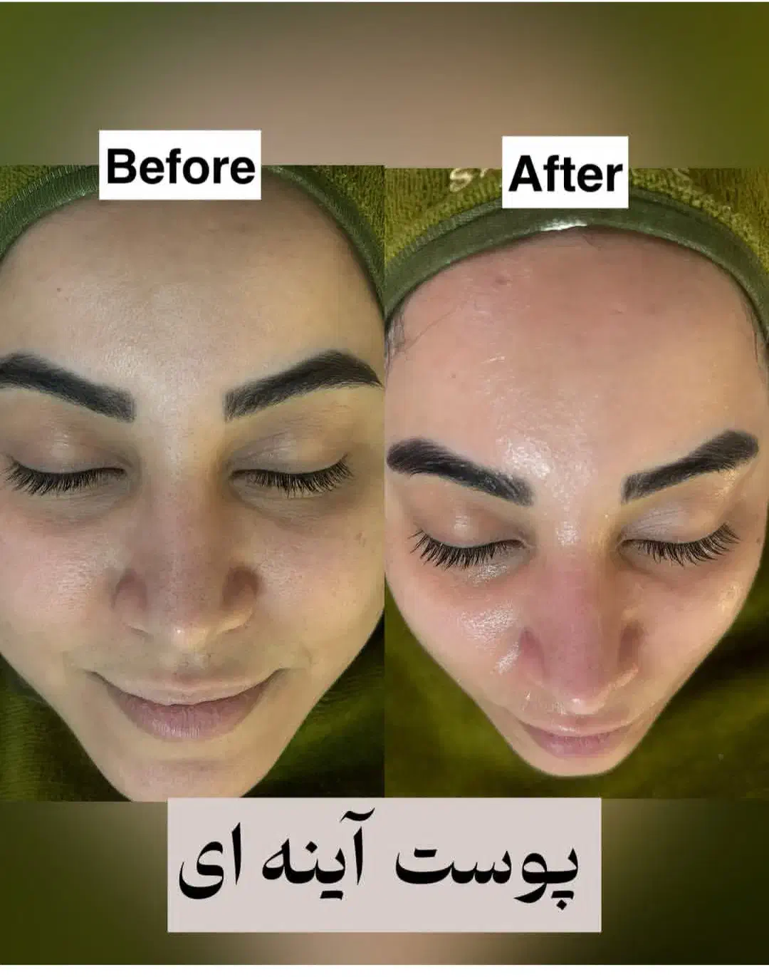 خدمات فیشیال ، پاکسازی ، جوانسازی پوست|خدمات آرایشگری و زیبایی|قم, شهرک قدس|دیوار