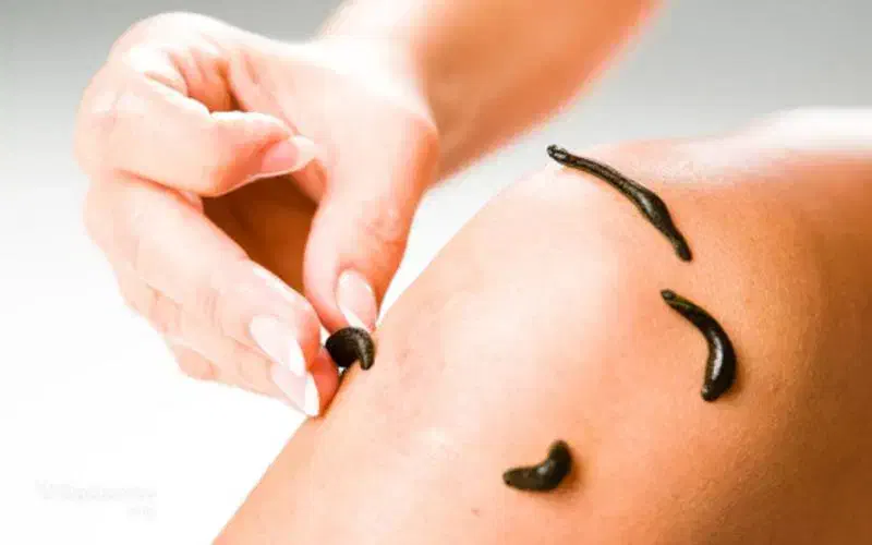 زالو درمانی و حجامت درطب سنتی با ۸ سال سابقه کار|خدمات آرایشگری و زیبایی|سبزوار, شرق کال میانی|دیوار