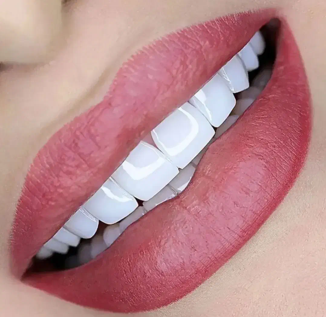 جشنواره کامپوزیت لمینت ، روکش|خدمات آرایشگری و زیبایی|تهران, دردشت|دیوار