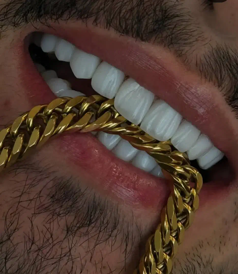 جشنواره کامپوزیت لمینیت عصب کشی روکش imax|خدمات آرایشگری و زیبایی|تهران, اقدسیه|دیوار