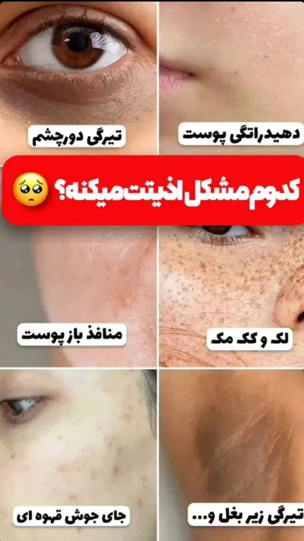 مراقبتی پوست و مو|آرایشی، بهداشتی، درمانی|سنندج, |دیوار