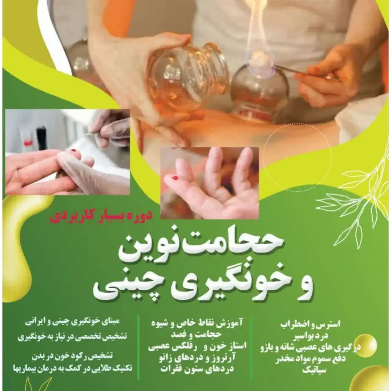 آموزش حجامت نوین و فصد چینی|خدمات آموزشی|تهران, مطهری|دیوار