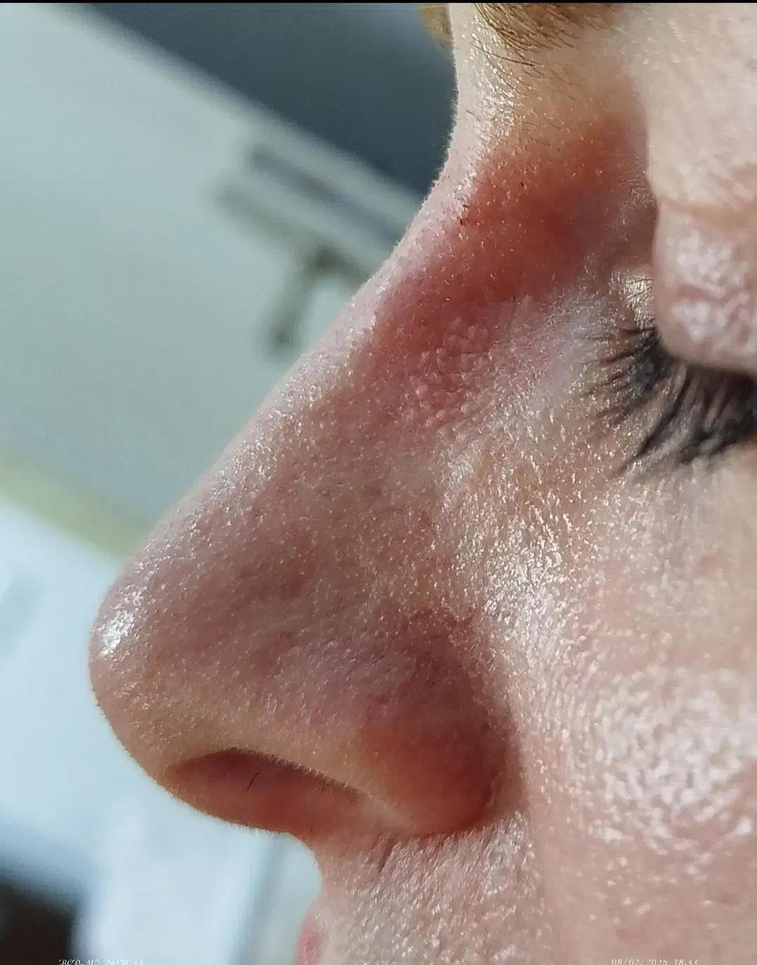 اصلاح فرم بینی بدون جراحی|خدمات آرایشگری و زیبایی|رشت, بلوار گیلان|دیوار