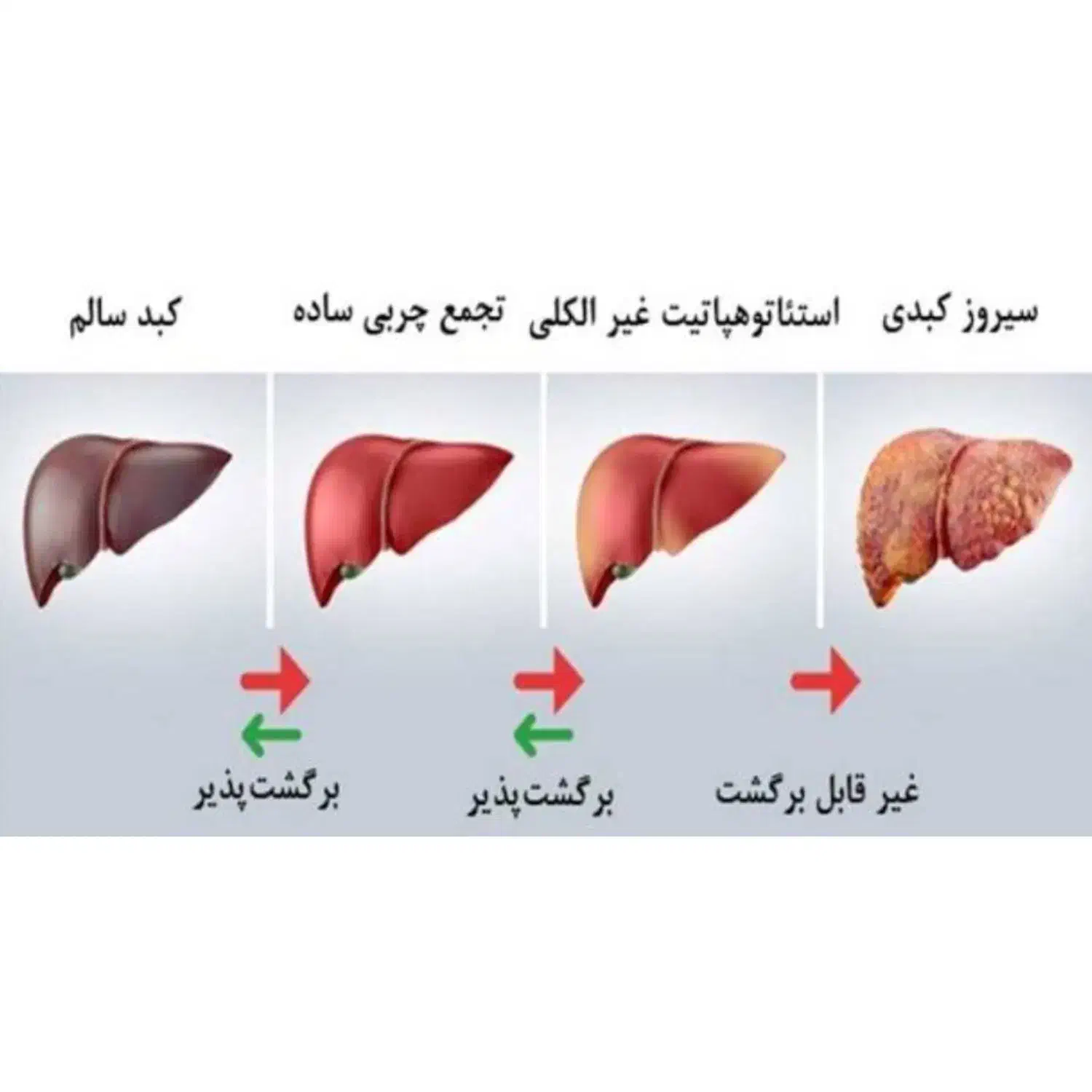 درمان کبد چرب|فعالیت داوطلبانه|لاهیجان, کوی خزر|دیوار