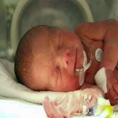 سوند تغذیه نوزاد (OGT / لوله معده) در منزل و مرکز|خدمات آرایشگری و زیبایی|زاهدان, |دیوار