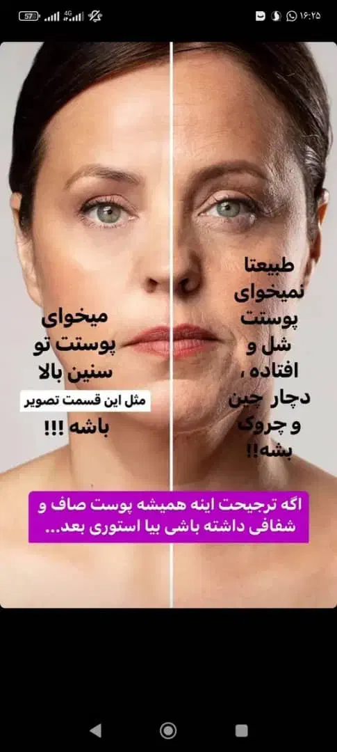 کرم چین و چروک|آرایشی، بهداشتی، درمانی|آباده, |دیوار