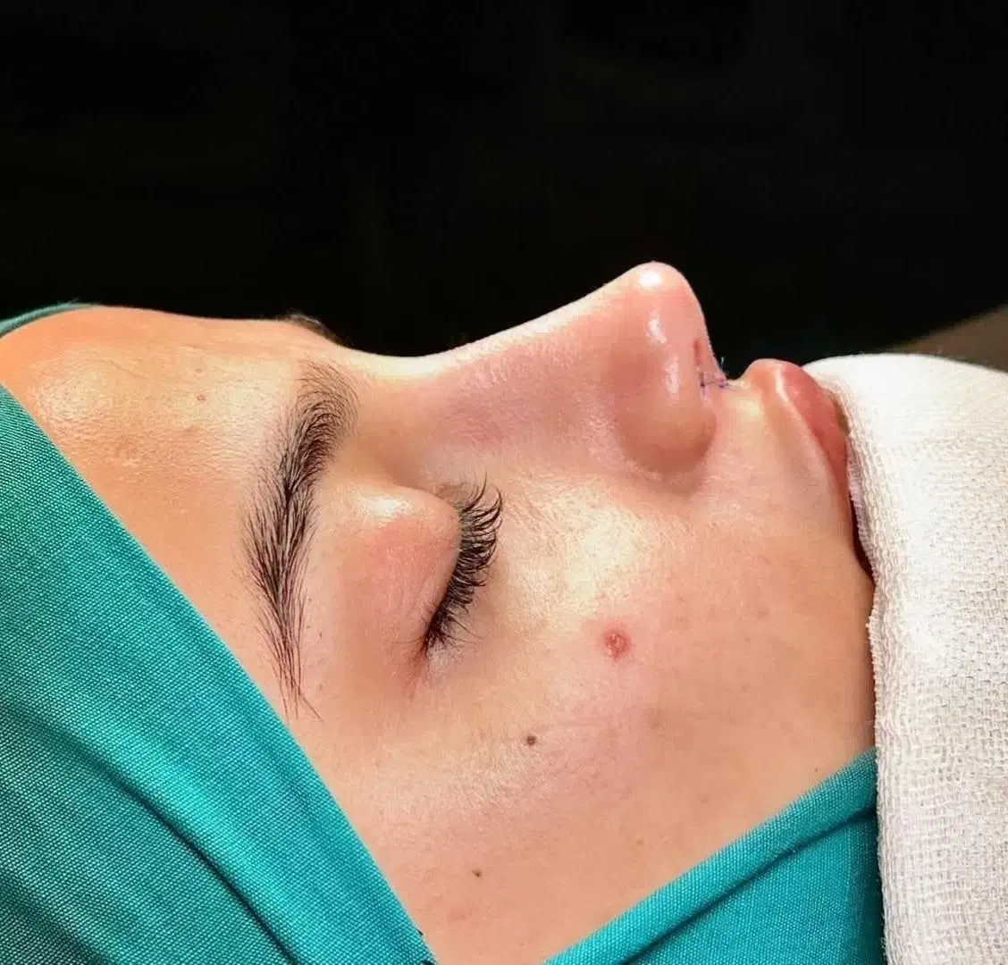 اخرین جشنواره عمل جراحی بینی لیپو ابدو لیفت وساکشن|خدمات آرایشگری و زیبایی|قم, شهرک امام حسن|دیوار