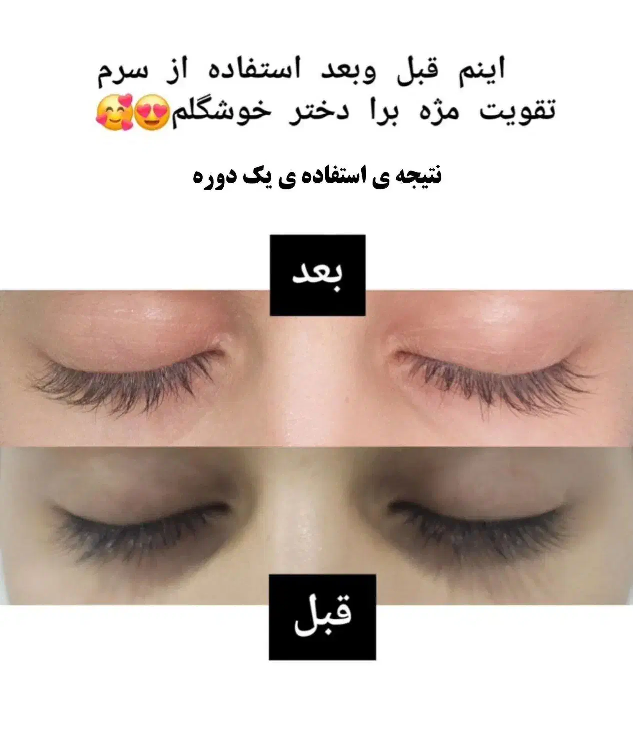 راه طبیعی رشد ابرو و مژه|آرایشی، بهداشتی، درمانی|تربت جام, امام|دیوار