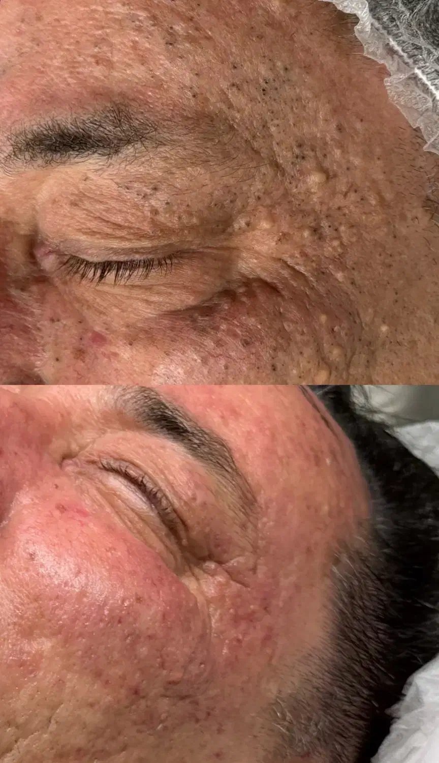 فیشال تخصصی اقایان کلینیک پزشک فقط یکشنبه۳۹۰|خدمات آرایشگری و زیبایی|بیرجند, |دیوار